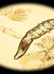 PREVALENCE OF DEMODEX MITES IN EYELASHES AMONG PEOPLE OF OAXACA, MEXICO