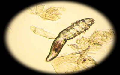 PREVALENCE OF DEMODEX MITES IN EYELASHES AMONG PEOPLE OF OAXACA, MEXICO