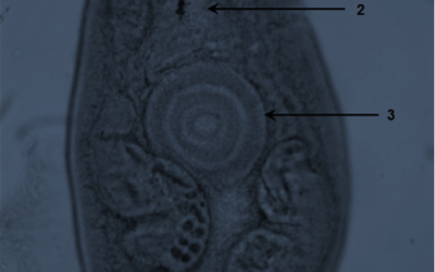 Detection of Paragonimus mexicanus (Trematoda) metacercariae in crabs from Oaxaca, Mexico